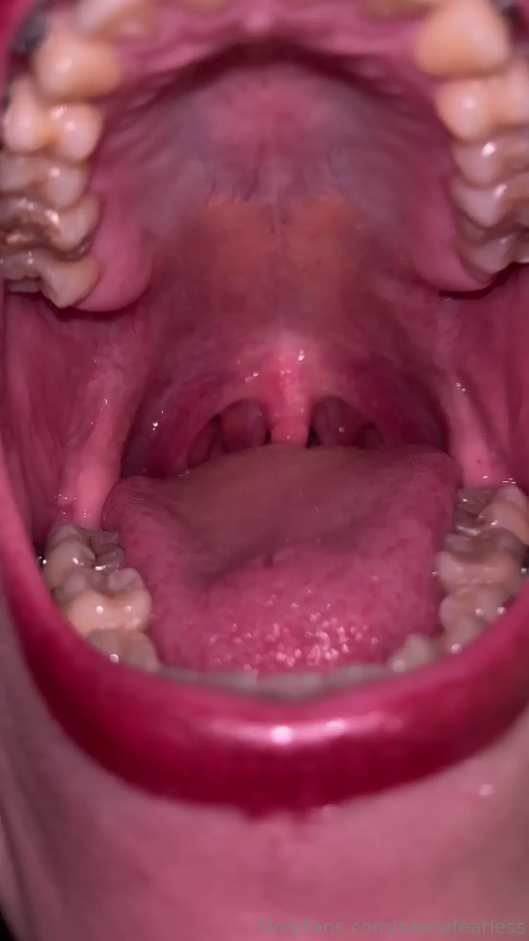 Very very very inside my morning tongue while saying ahhhh can you 