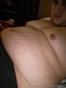 Took some midnight pics and realised how crazy my stretchmarks are