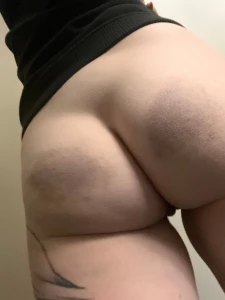 How did i get bruisey come see i love paddle spanks