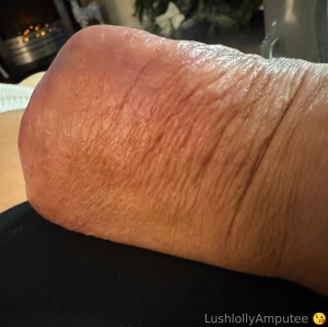 This is my right hand no fingers due to amputation the tatoo is what i part 1