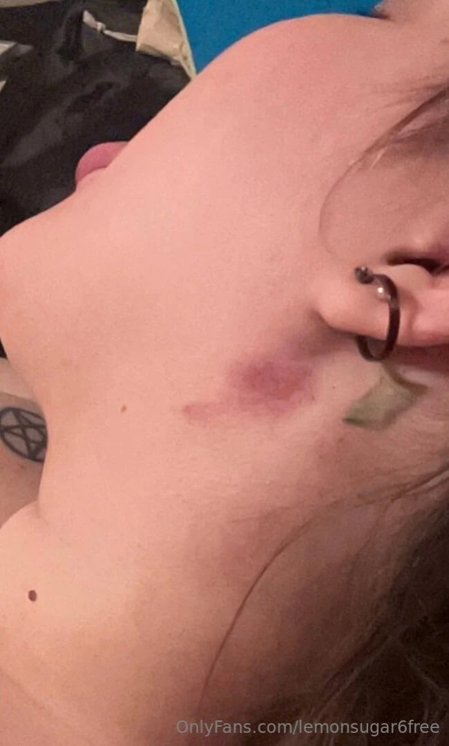 A couple of hickey pics because they re my favorite part 1 