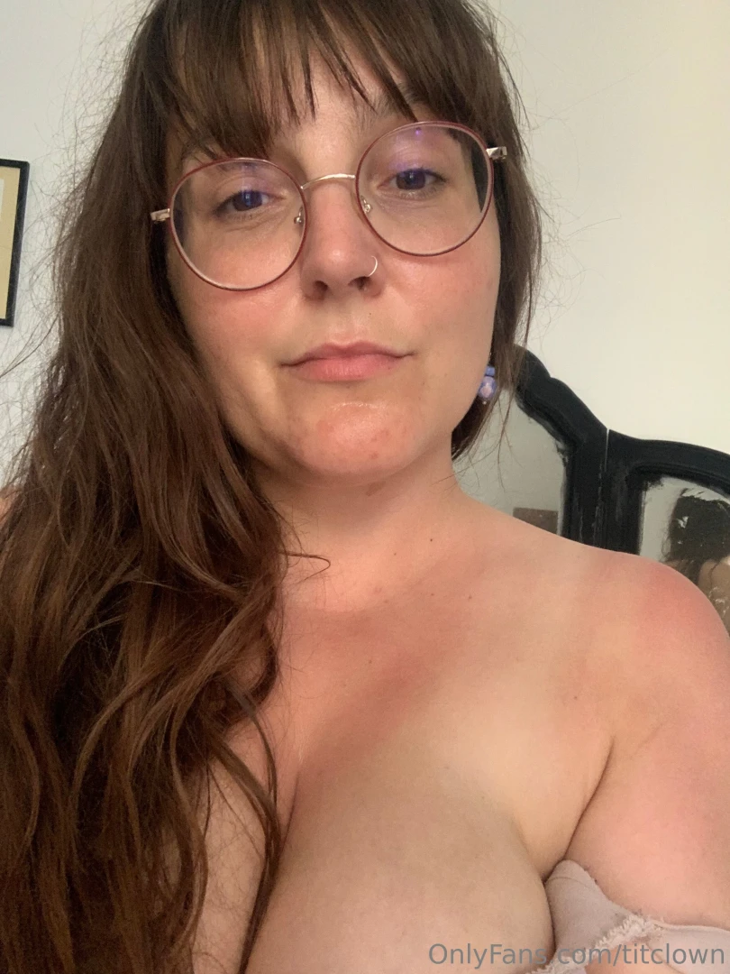 Caught a nasty sunburn this weekend would you kiss it better 
