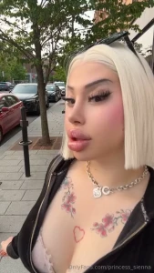 Fresh lip filler and platinum blonde bob moment for my mental health