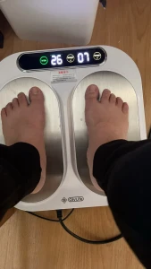 This machine sends electric ion therapy to my legs and fat feet it part 5