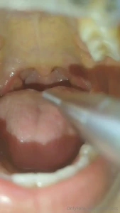 New uvula video