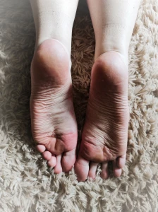 My big feet are so swollen and sweaty today