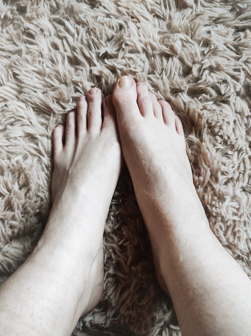 My feet are so swollen today you can see the imprint of the socks on part 1 