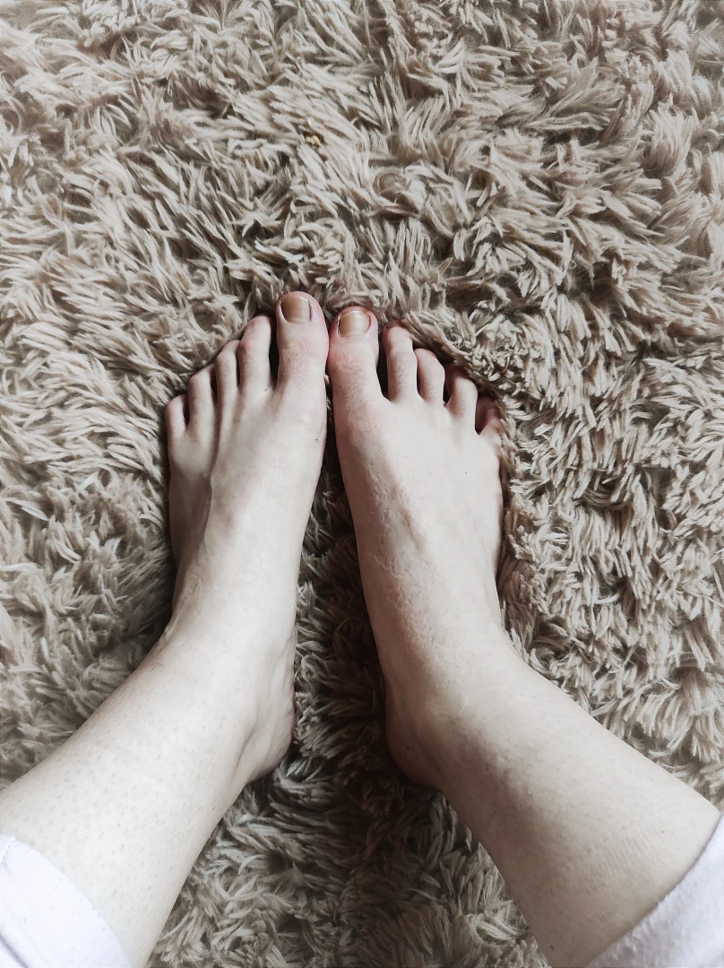 My feet are so swollen today you can see the imprint of the socks on 