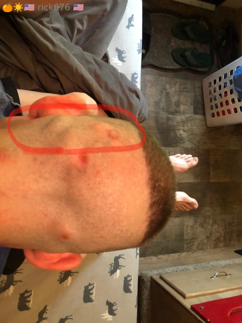My problem and my procedure to try and repair it i normally have hair part 1 
