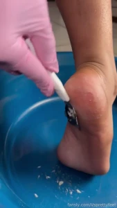 Stinky crusty feet dont you just lov all of this foot dust and dry part 2