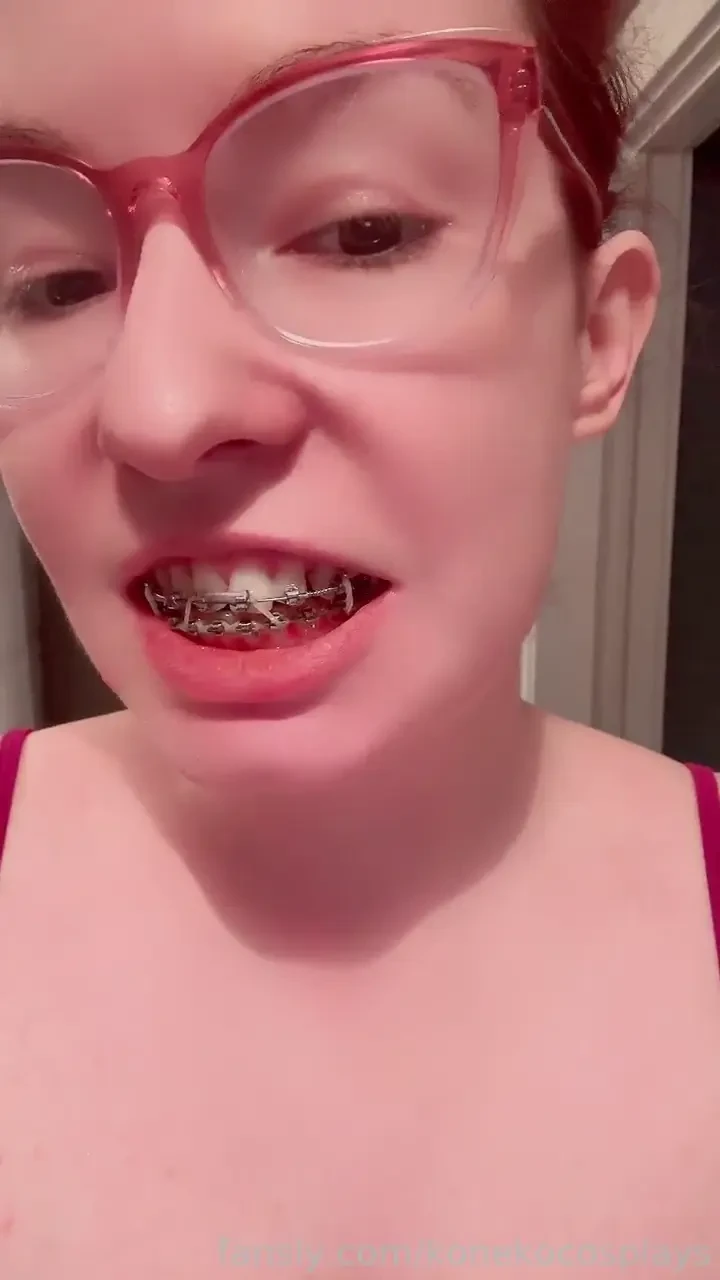 Nom nom elastics haha the current elastic situation 3 