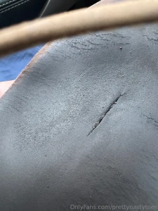 Update on my rainbow flip flops