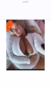 Who wants to treat me and pay for my lip fillers for the first time