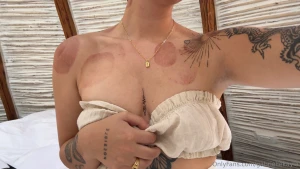 Whose been leaving all these hickies on me