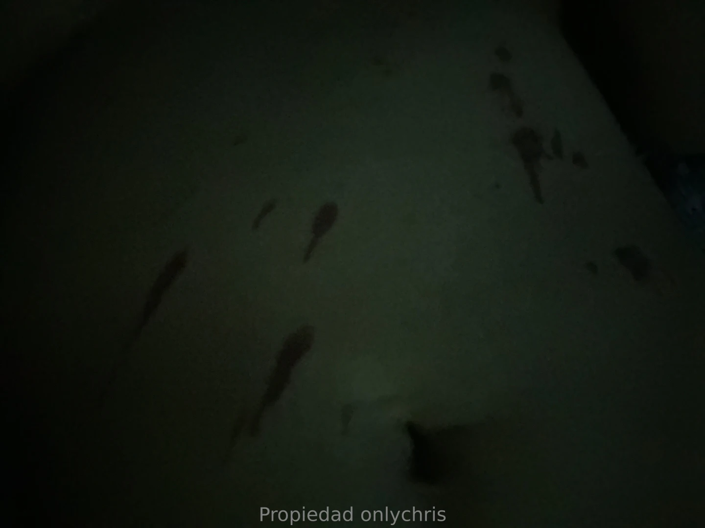 Chic s me da e mi barriguita con quemaduras estuve un poco 