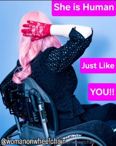 Diverse or disabled models male or female are beautiful if you think