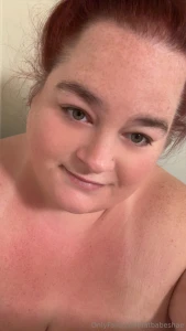 About to have surgery wish me luck part 2