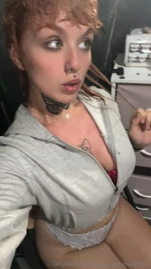 My tan lines are so dark where my sunburn is still healing but it s part 1