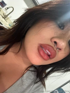 How are we today part 1