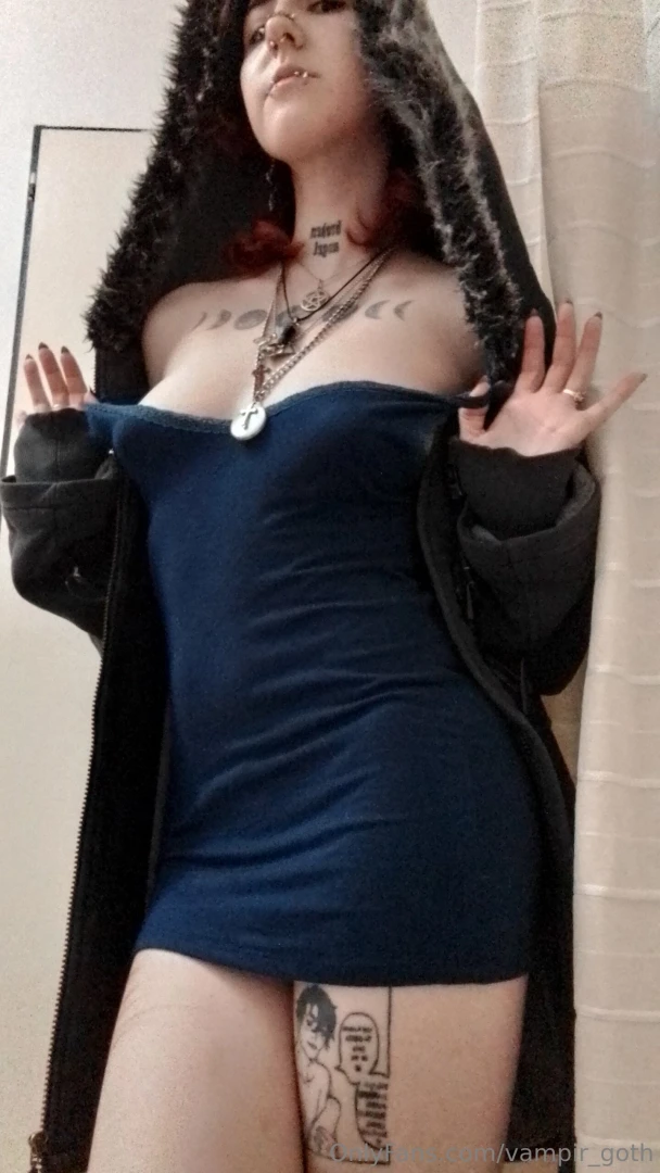 Blue dress do i look strange i have bruises part 2 