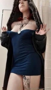 Blue dress do i look strange i have bruises part 2