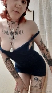 Blue dress do i look strange i have bruises