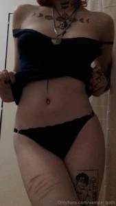 Blue dress do i look strange i have bruises part 1