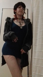 Blue dress do i look strange i have bruises part 3