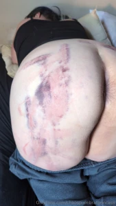 Such pretty bruises and such a fun night the spanking was intense but