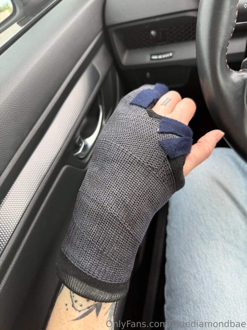 Bidding starts at 75 for my used cast that comes off in 4 weeks 