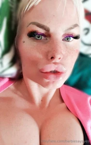 7 ml stylage xl lips