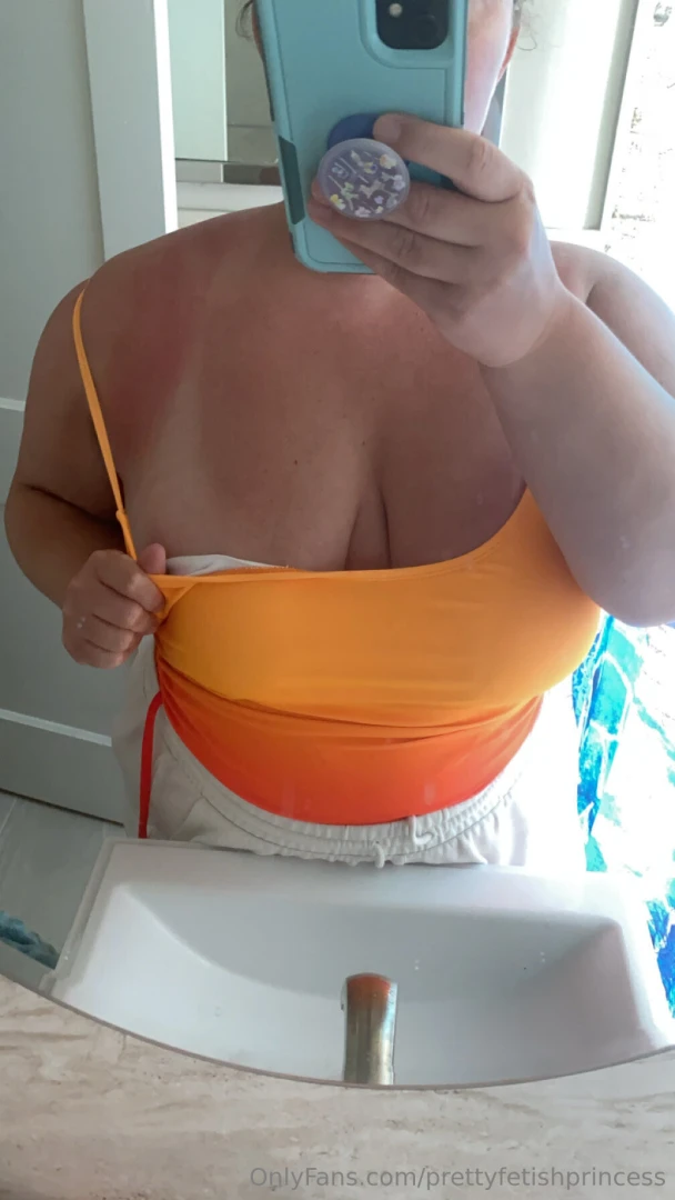 I got so sunburned someone send me aloe part 1 