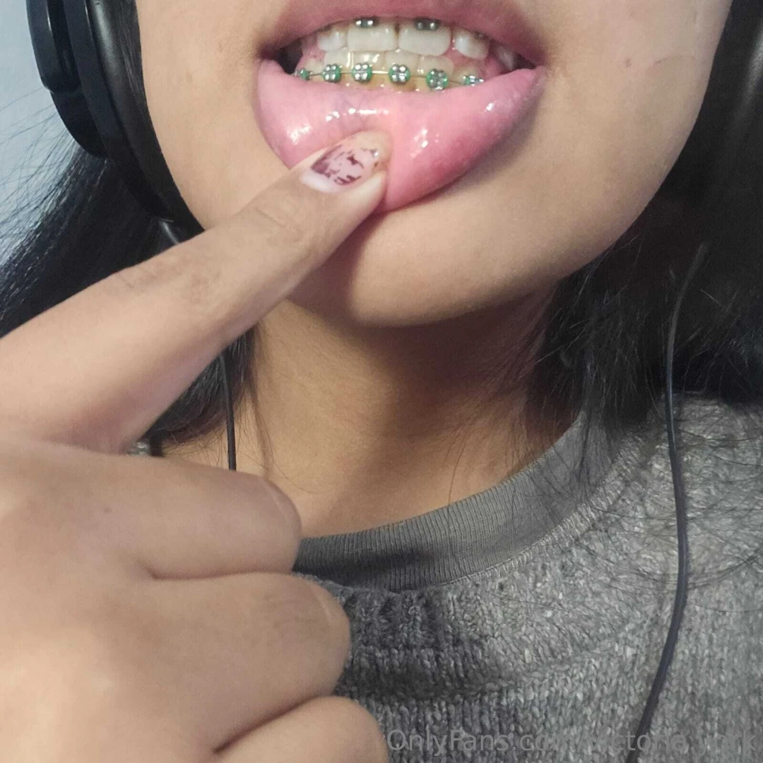 Like this post if you think braces are sexy 