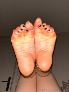 Nice and swollen from being on my feet for 14 hours