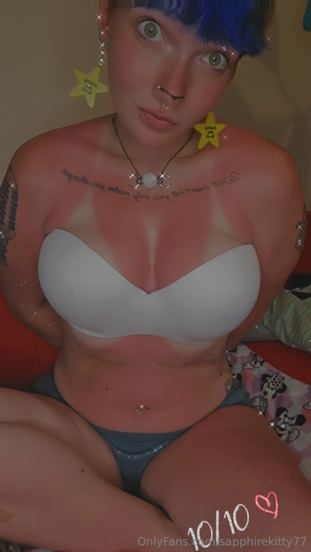 Will you rub some aloe on me please 