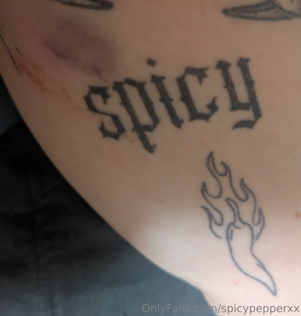 Who left this spicy bruise on my arm i wonder 