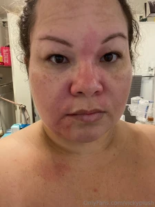 Well the truth behind that video is that i had a bad reaction to the