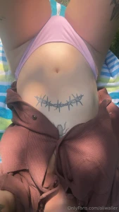 What would you do part 311