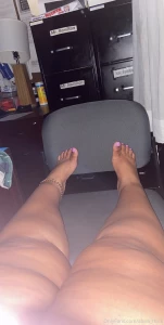 My toes are so fat