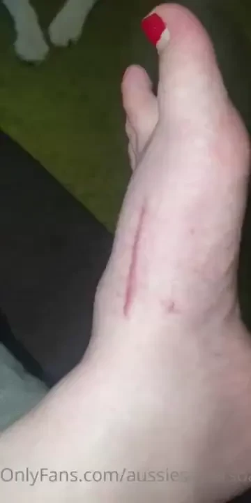 My next foot appointment with the specialist is on the 23rd and i m 