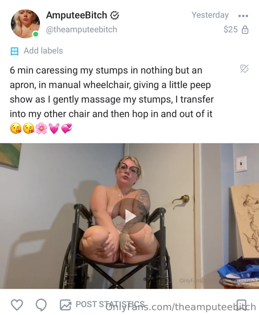 Theamputeebitch1 