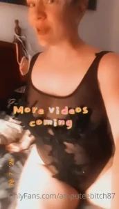 Theamputeebitch1 part 84