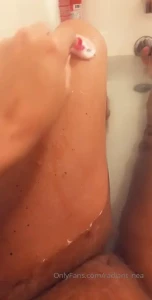 Freckles anyone