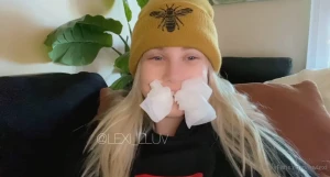 Update wisdom tooth surgery went better than expected going to be