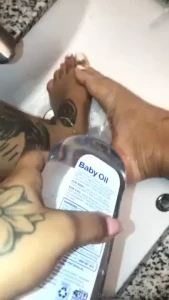 Cold wet feet