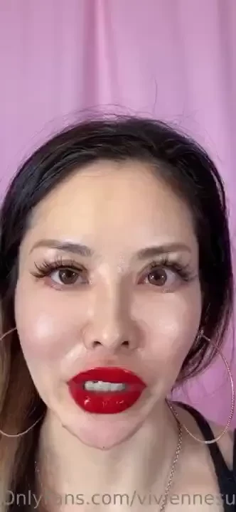 1 8cc lip fill 0 5 chin fill i wanted 2cc lip but 1 8 is maximum this 