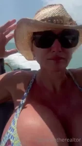 So sunburned in need of aloe and no sun for a few days part 1