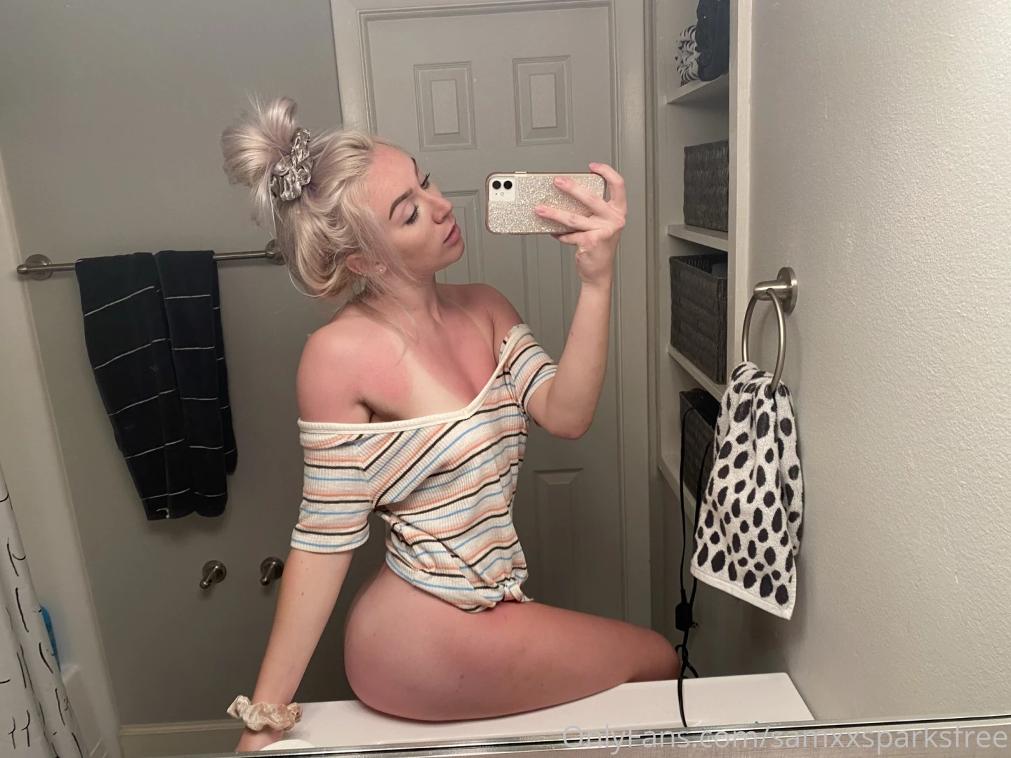 Got sunburnt sent tips to make me feel better 