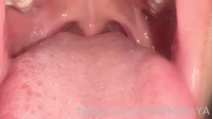 Inside my mouth