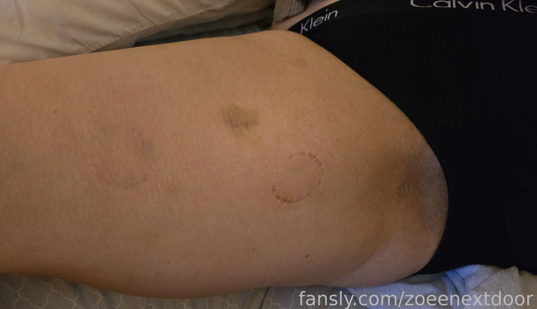 People tell me that my thighs look biteable all the time turns out y 